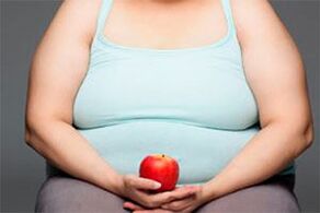 За да излекувате разширените вени, трябва да свалите излишните килограми